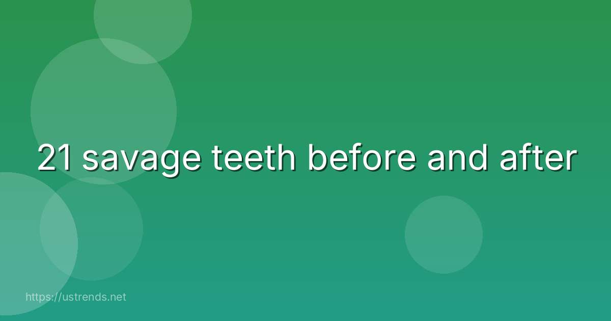 21 savage teeth before and after