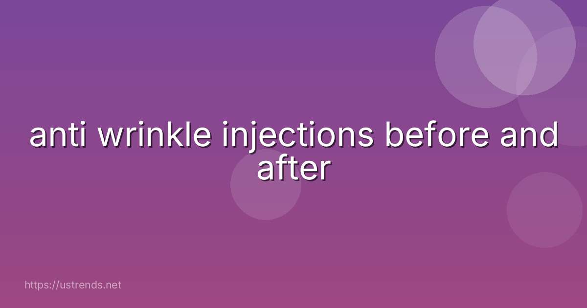 anti wrinkle injections before and after