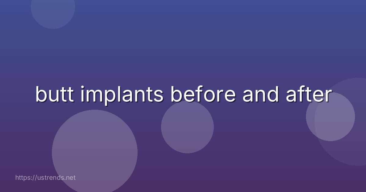 butt implants before and after