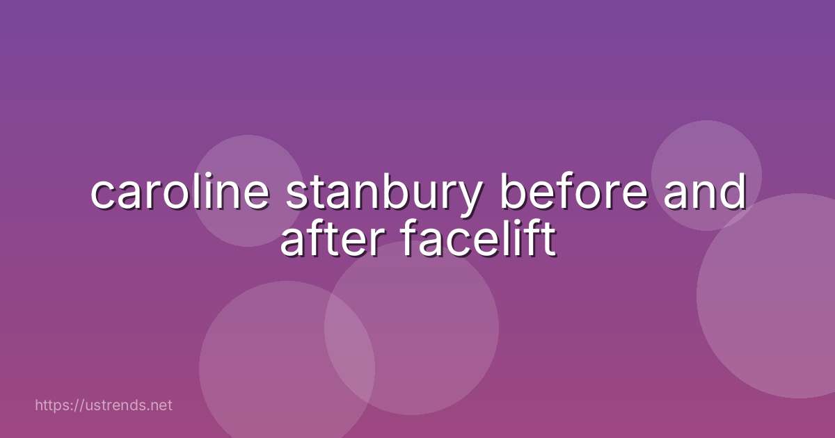 caroline stanbury before and after facelift