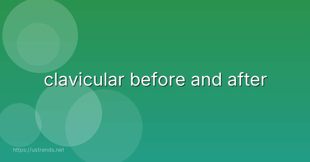 clavicular before and after