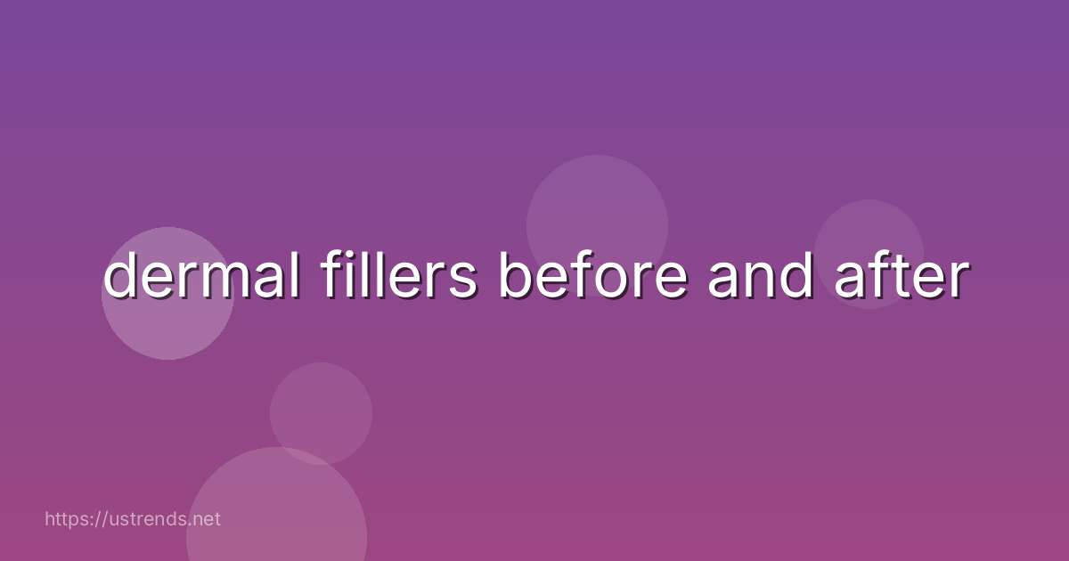 dermal fillers before and after