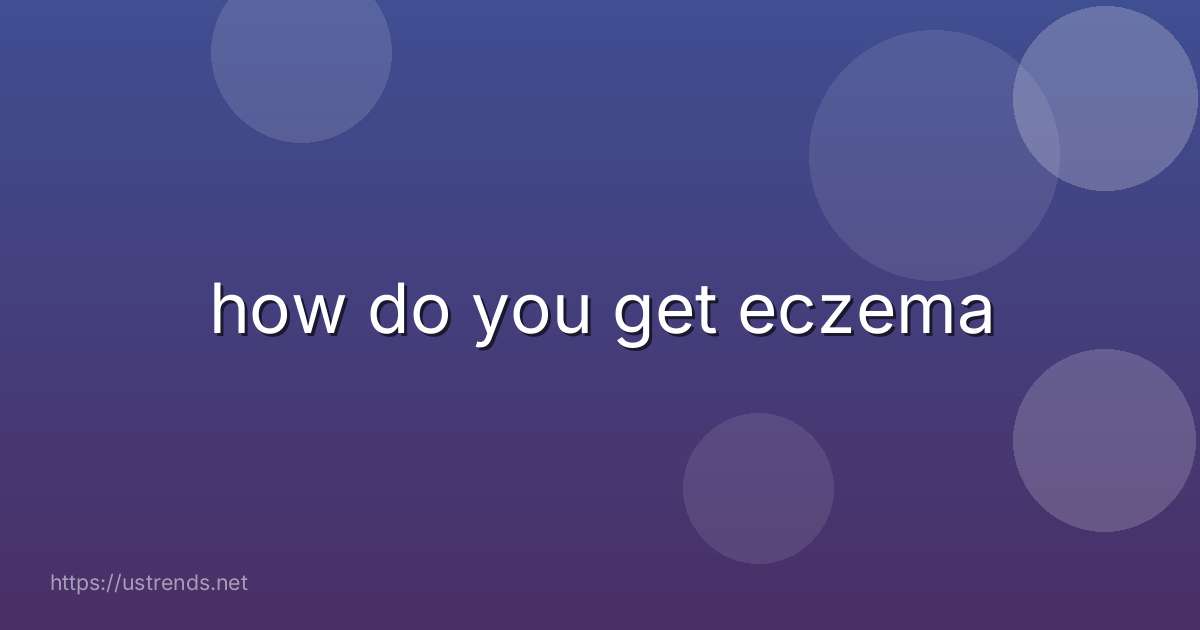 how do you get eczema