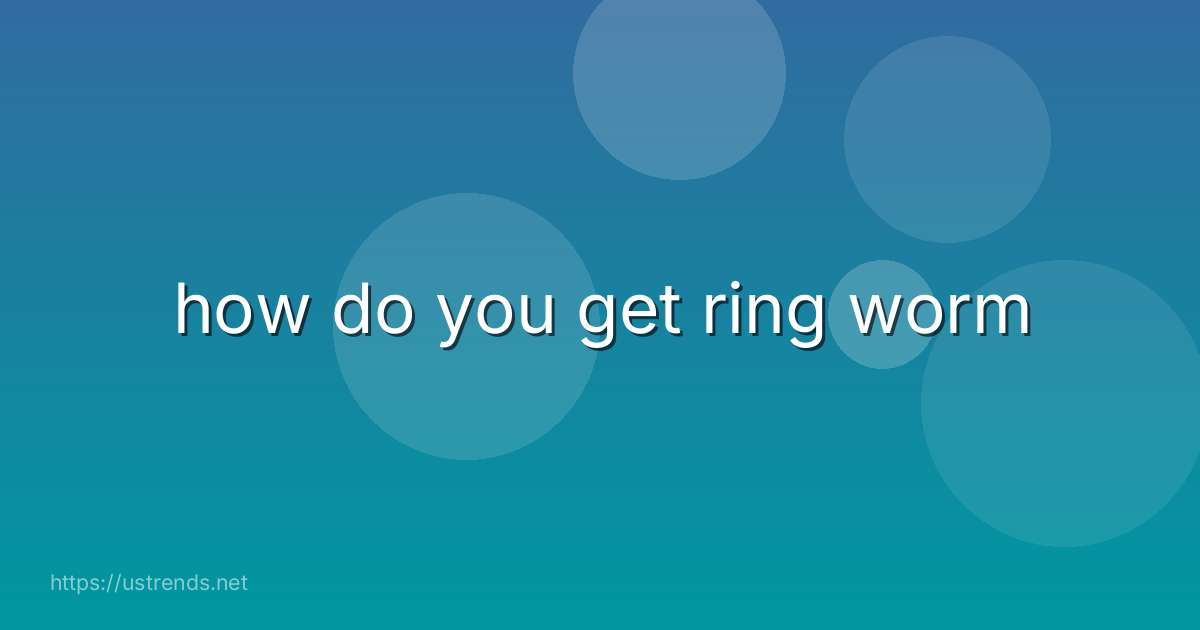how do you get ring worm