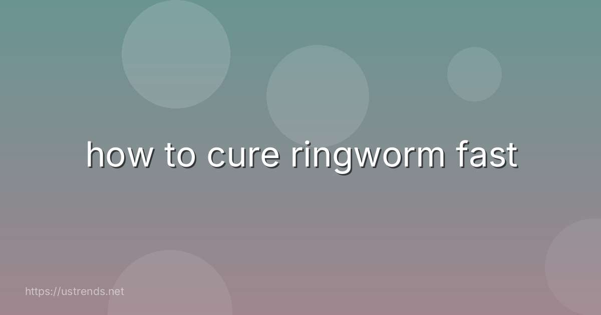 how to cure ringworm fast