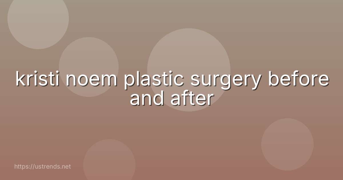 kristi noem plastic surgery before and after