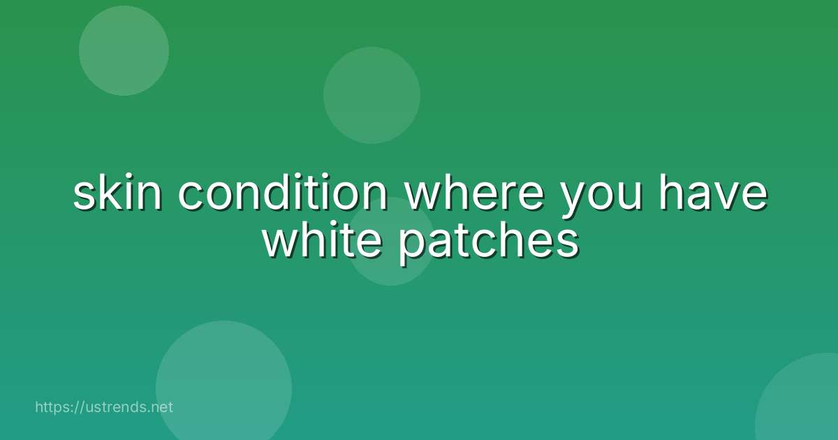 skin condition where you have white patches