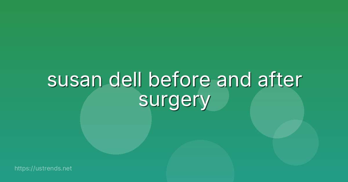 susan dell before and after surgery