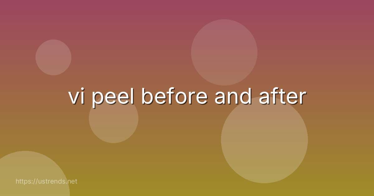 vi peel before and after