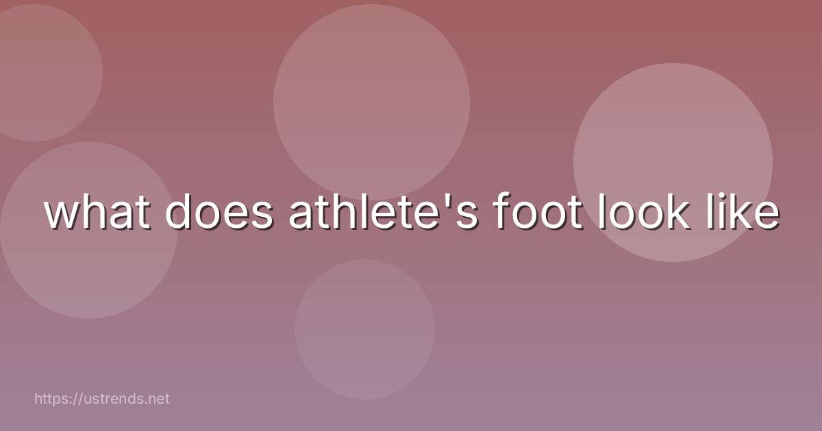 what does athlete's foot look like