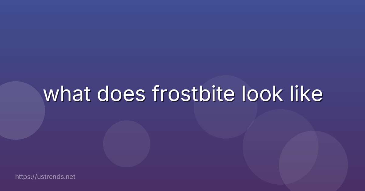 what does frostbite look like