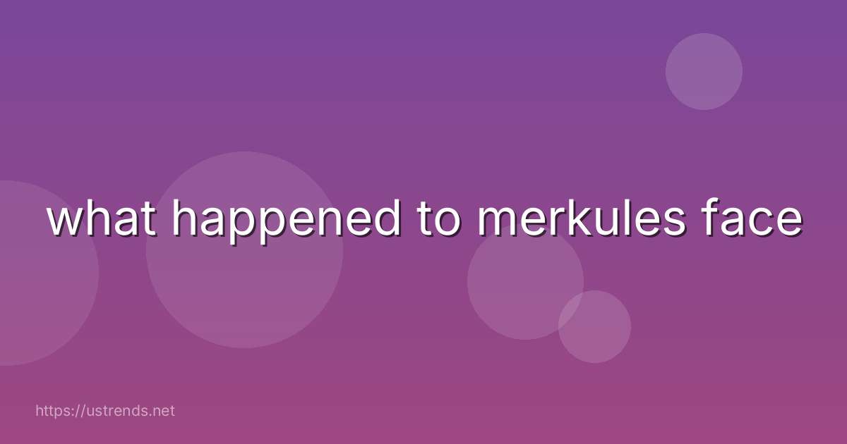what happened to merkules face