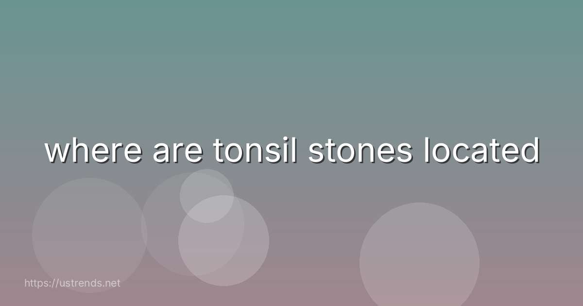 where are tonsil stones located